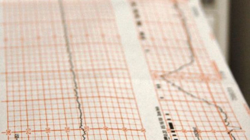 EKG Graph Paper